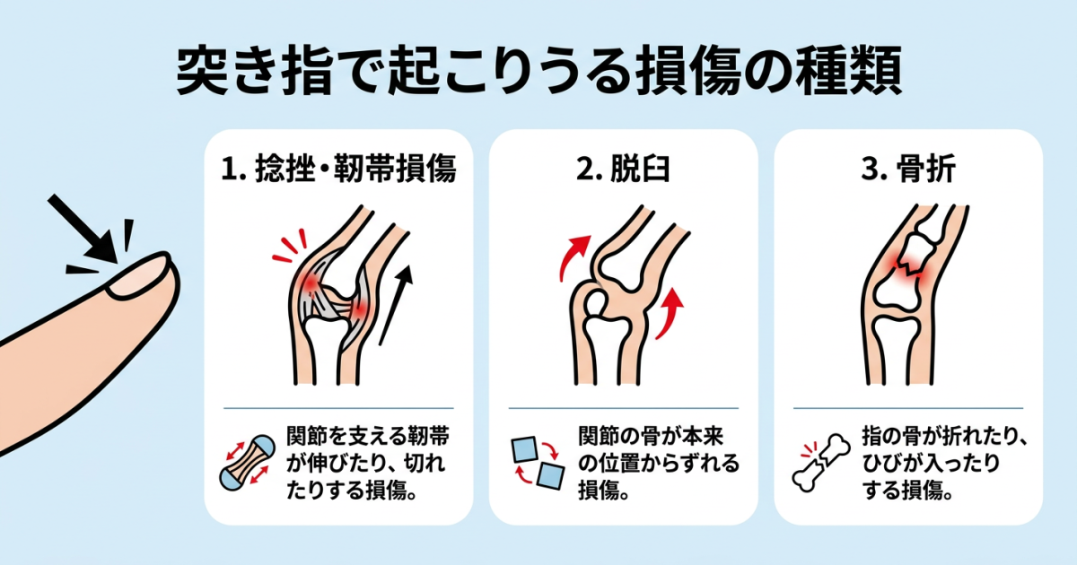 ■突き指とは？指に起きているケガの正体